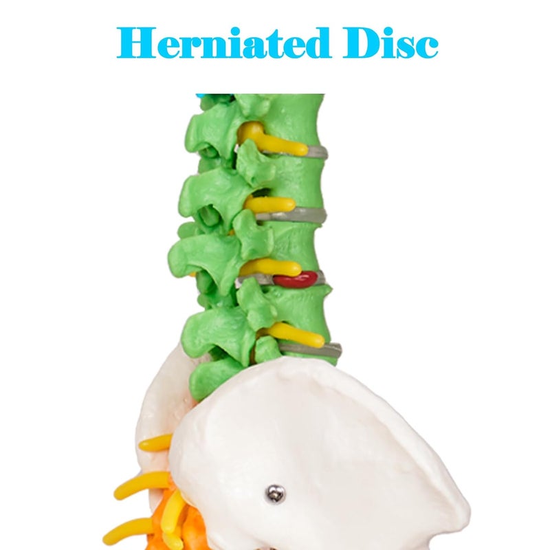 breesky Scientific Mini Spine Model, 15.5’’ Anatomical Spine Model with All Nerves, Human Anatomy Model with Stand for Instruction, Study and Display - Image 5
